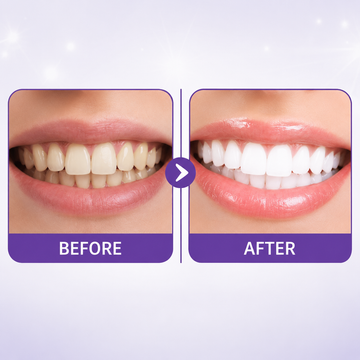 ORALIX - Teeth Whitening Strips (Ultra Strong Whitening)